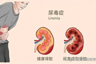 巴雷拉代表意大利国家队出场50次，在目前球队中仅次于多纳鲁马